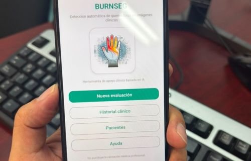 Estudiante de FING-UACH desarrolla app para detectar quemaduras de piel con el celular